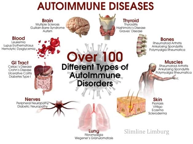 glandular fever consequences