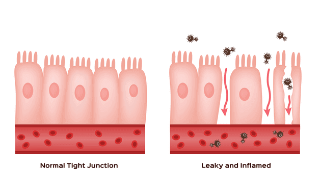 auto immune diseases